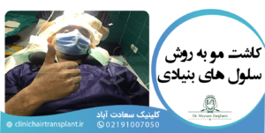 کاشت مو به روش سلول های بنیادی