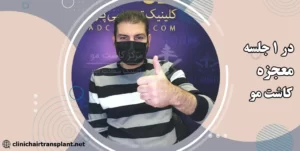همه چیز درباره معجزه کاشت مو