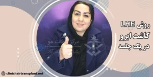 کاشت ابرو به روش LHE در یک جلسه