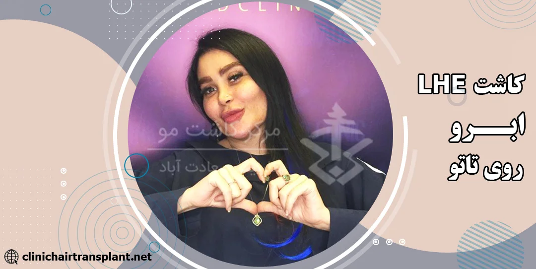 کاشت ابرو روی تاتو به روش LHE