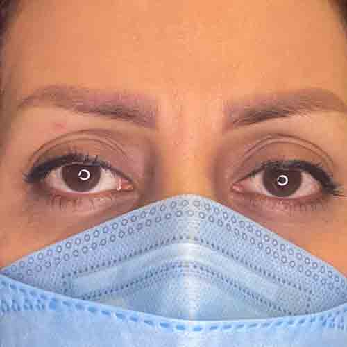کاشت ابرو طبیعی بدون نیاز به جراحی با روش LHE