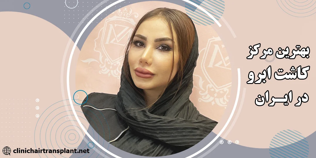 بهترین مرکز کاشت ابرو در ایران کجاست؟