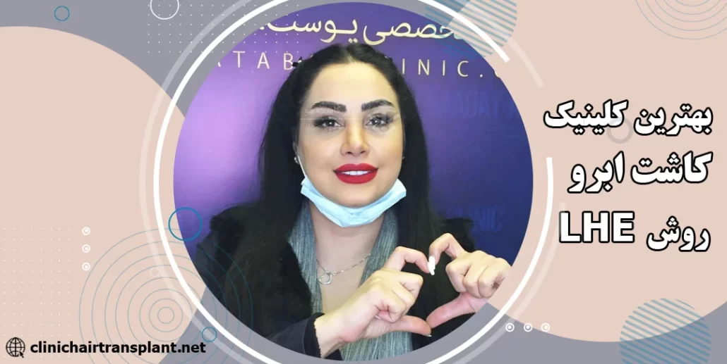 بهترین کلینیک کاشت ابرو به روش LHE