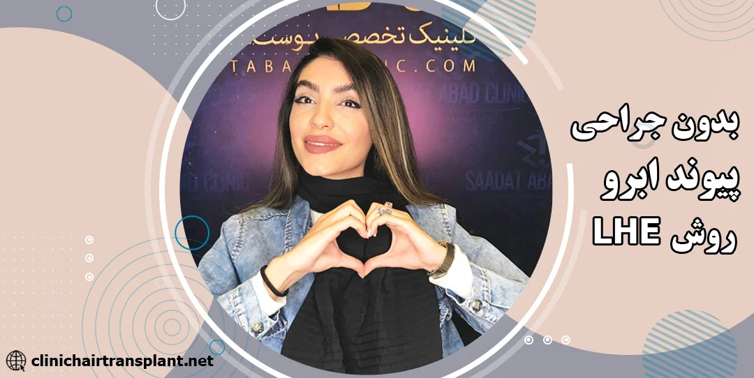پیوند ابرو با روش ال اچ ای