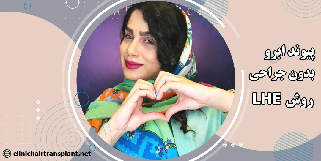 پیوند ابرو بدون جراحی LHE