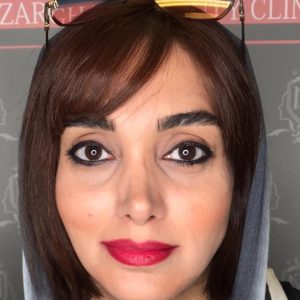 کاشت طبیعی ابرو بدون جراحی