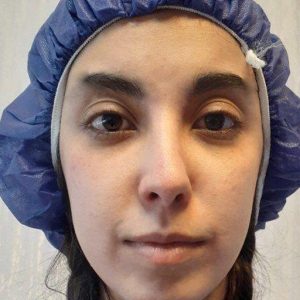 انواع روش های کاشت ابرو