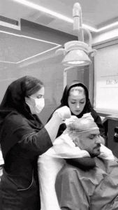 کاشت مو با سلولهای بنیادی