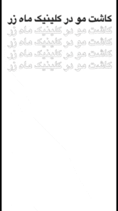 کاشت مو سر قبل و بعد