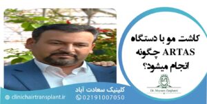 کاشت مو با دستگاه ARTAS