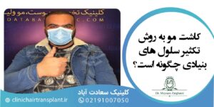 کاشت مو به روش تکثیر