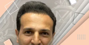 کاشت مو به روش تکثیر