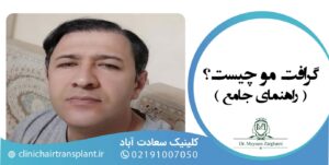 گرافت مو چیست؟