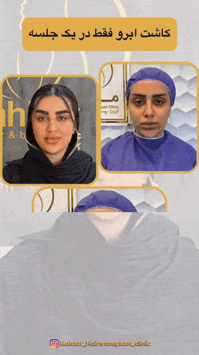 کاشت ابرو فقط در یک جلسه