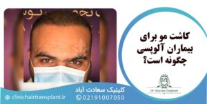 کاشت مو برای بیماران آلوپسی