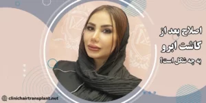 بهترین روش و زمان اصلاح ابرو بعد از کاشت
