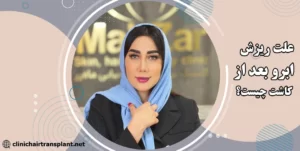ریزش ابرو بعد از کاشت