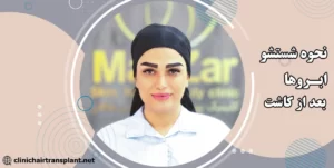 شستشو ابرو بعد از کاشت