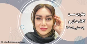 کاشت ابرو در چه سنی مناسب است؟