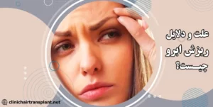 دلایل ریزش ابرو چیست؟
