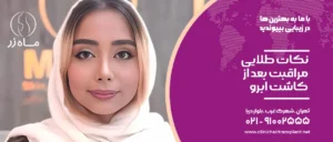 مراقبت از ابرو