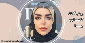 روش چهار گانه کاشت ابرو