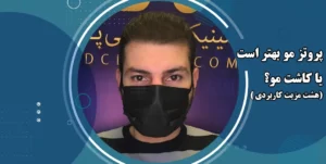 پروتز مو بهتر است یا کاشت مو