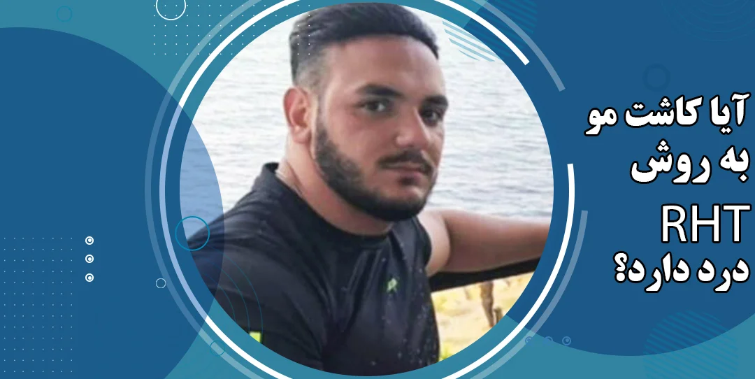آیا کاشت مو rht درد دارد