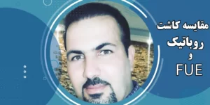 مقایسه کاشت مو به روش RHT و FUE