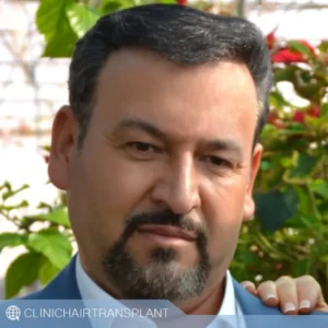 کاشت مو روبوتیک دائمی