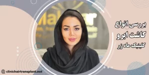 انواع کاشت ابرو