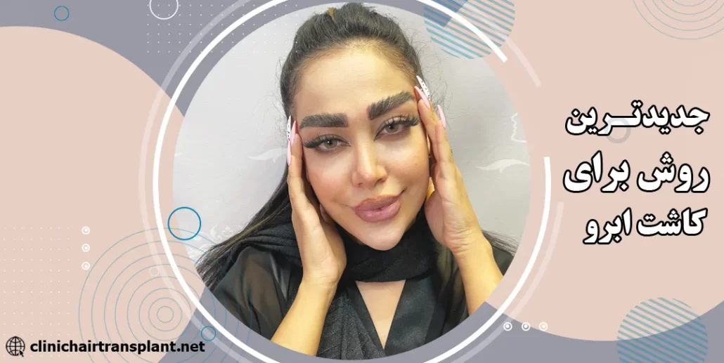 جدیدترین روش کاشت ابرو چیست؟