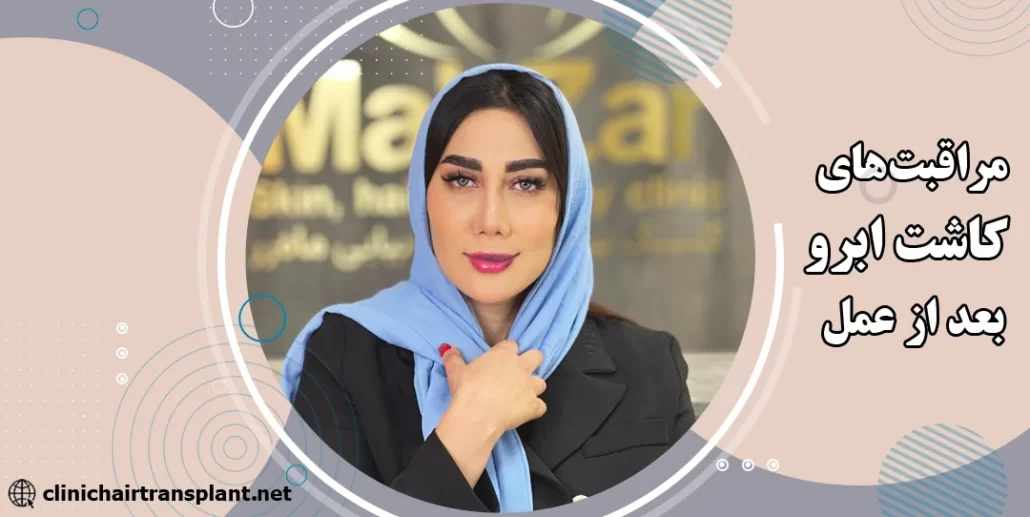 مراقبت بعد از کاشت ابرو