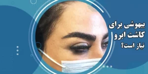 برای کاشت ابرو بیهوشی دارد؟