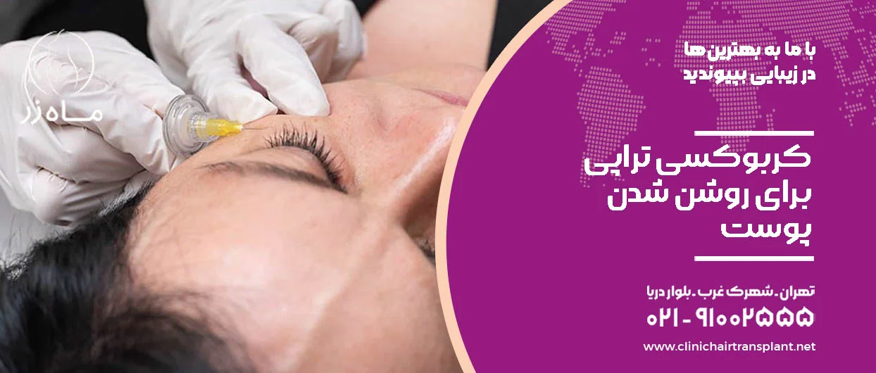 کربوکسی تراپی برای روشن شدن پوست