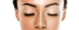 کربوکسی تراپی برای روشن شدن پوست