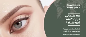چه کسانی نباید کاشت ابرو کنند؟