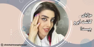 مزایا کاشت ابرو