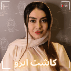 عوارض کاشت ابرو بایوگرافت