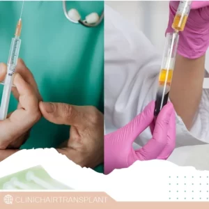 مزایای پی آر پی پس از کاشت مو