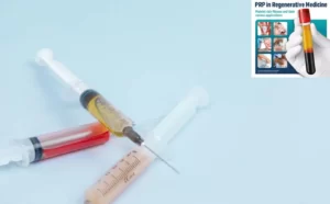 PRP چگونه کار می کند