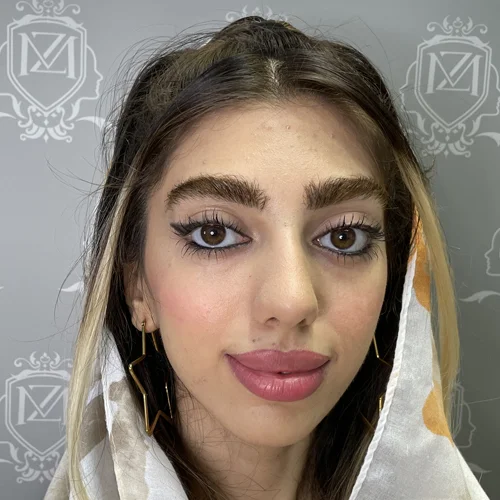 بعد از کاشت ابرو در یک جلسه