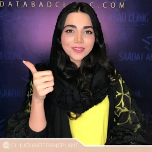 فواید کاشت ابرو بایوگرافت
