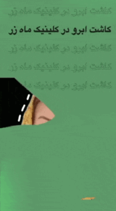 نمونه کاشت ابرو