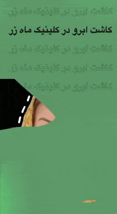 نمونه کاشت ابرو