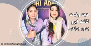 هزینه کاشت ابرو بدون جراحی چقدر است؟