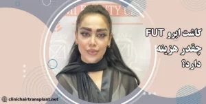 هزینه کاشت ابرو به روش fut