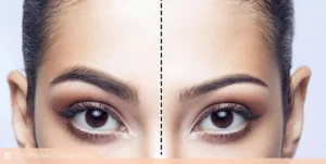 کاشت ابرو fut چقدر هزینه دراد؟