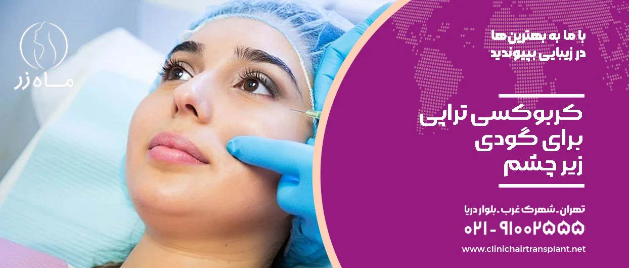 کربوکسی تراپی برای گودی زیر چشم