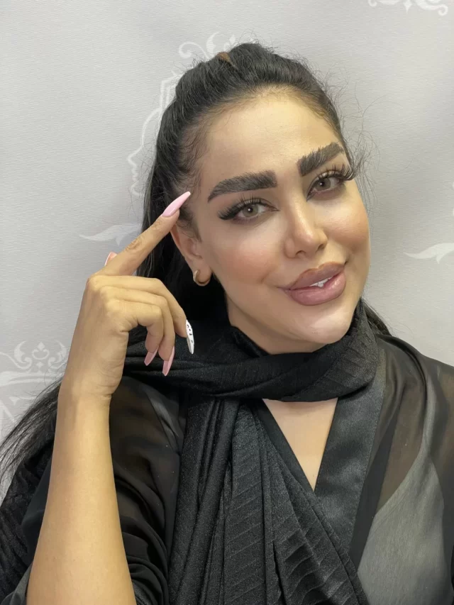 کاشت ابرو در یک جلسه